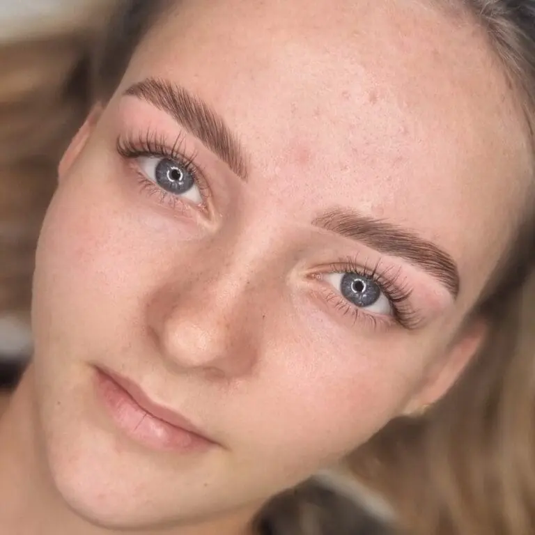 Eksempel på brow lift